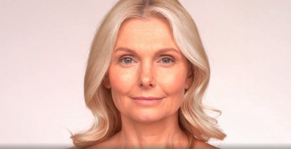 Rellenos faciales con ácido hialurónico.