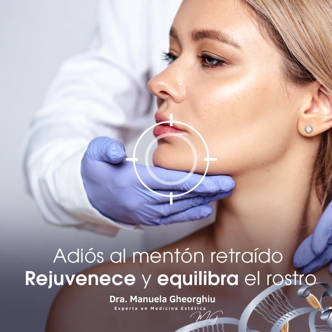 Adiós al mentón retraído con nuestro relleno de mentón.
