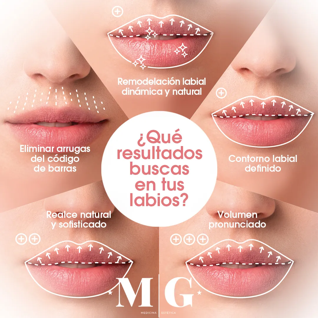 ¿Qué resultados buscas en tus labios?