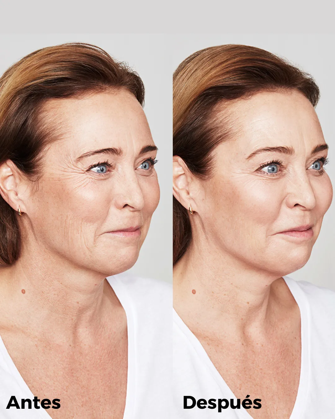 Antes y después de eliminar las patas de gallo.