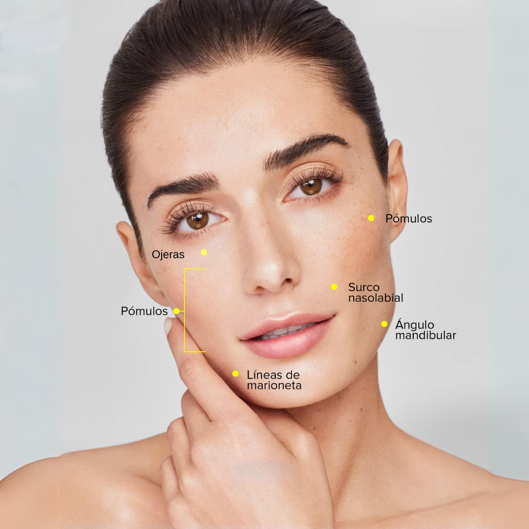 Zonas de tratamiento rellenos con acido hialuronico.